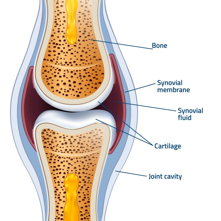 Joint Problem