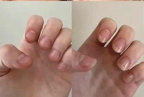Nail Problem